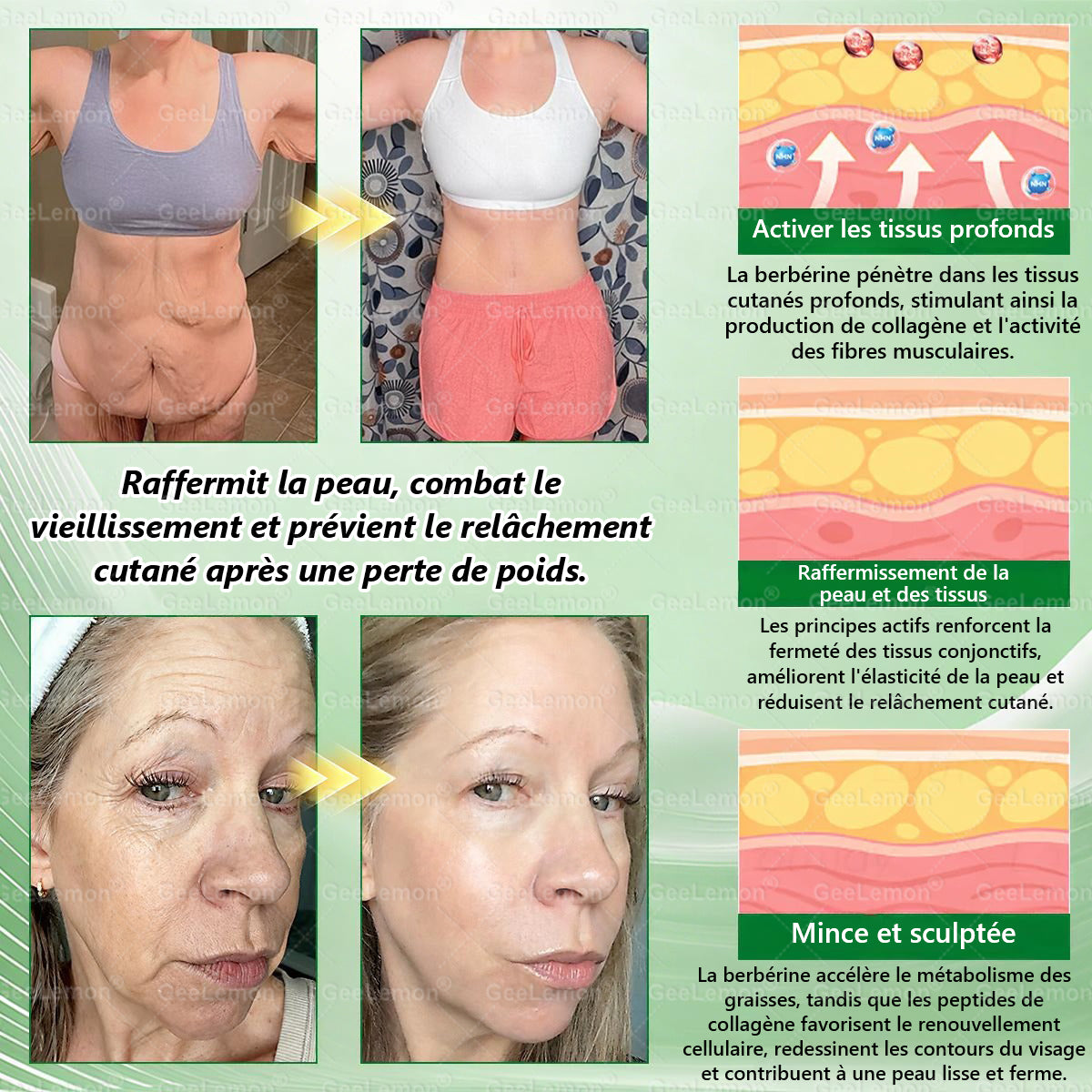 🫙🩸 𝐆𝐞𝐞𝐋𝐞𝐦𝐨𝐧® Moringa · Berberine × NAD+ 10 en 1 Patch Nano-Microneedle Avancé (À utiliser une fois par jour. Résultats visibles en 7 jours)