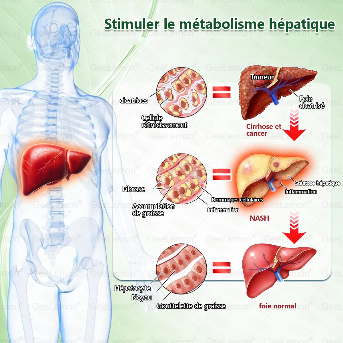 🫙🩸 𝐆𝐞𝐞𝐋𝐞𝐦𝐨𝐧® Moringa · Berberine × NAD+ 10 en 1 Patch Nano-Microneedle Avancé (À utiliser une fois par jour. Résultats visibles en 7 jours)